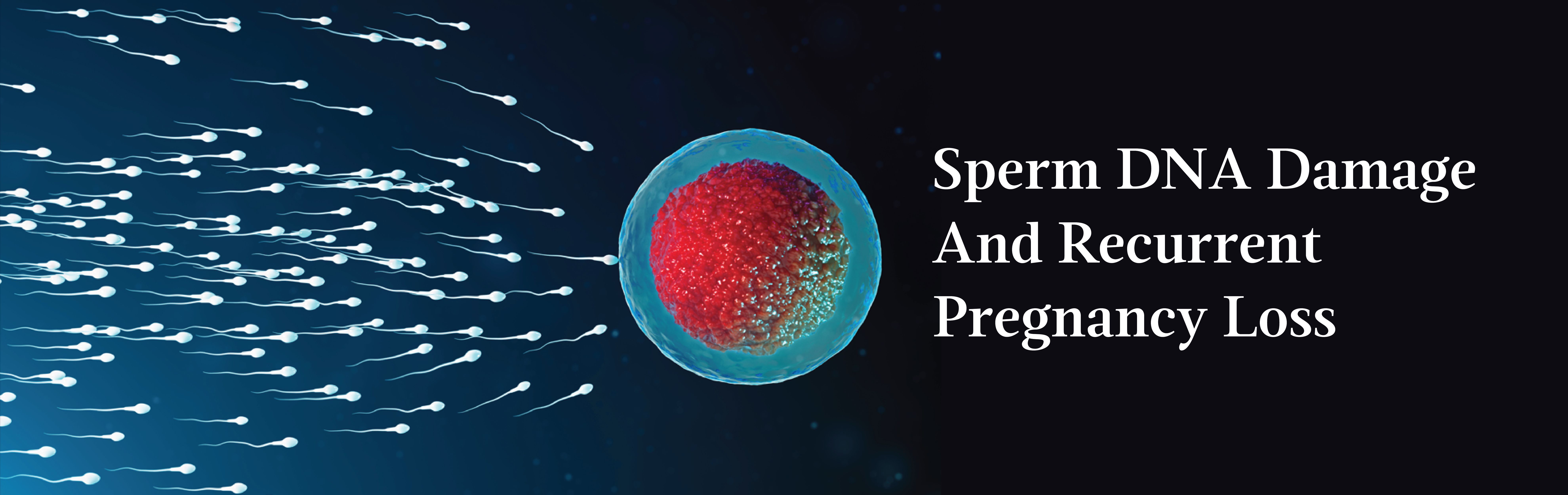 The Role Of Sperm DNA Damage In Recurrent Pregnancy Loss