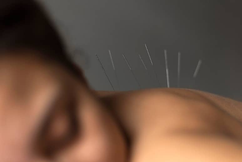 Five Forbidden Acupuncture Points: Meaning, Risks & Benefits