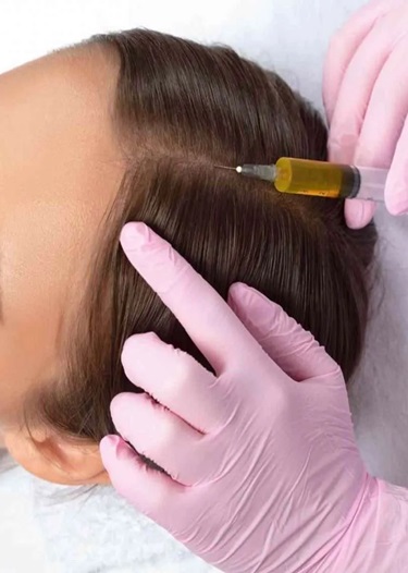 PRP Hair Treatment Dandenong & Dandenong South