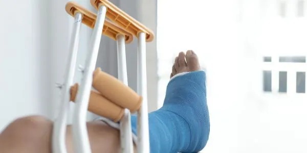 Understanding Internal Fixation: A Guide to Fracture Treatment - AVee Hospital Vaishali