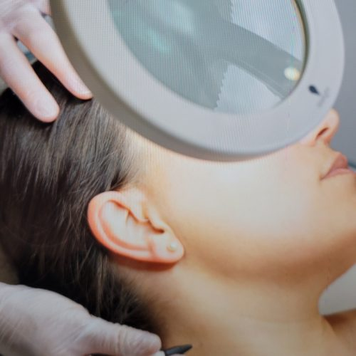 Top Benefits of Electrolysis for All Skin Types: ext_6785659 — LiveJournal
