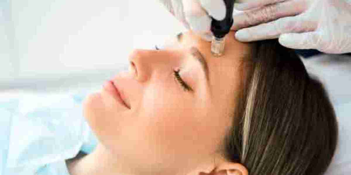 Achieving Even Skin Tone with a Calgary Dermatologist