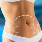 liposuction in Islamabad