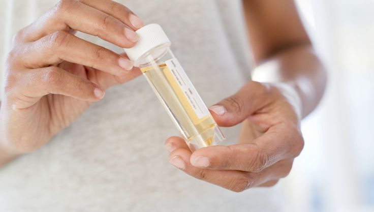 Do Urinary Tract Infections Lead to Kidney Damage?