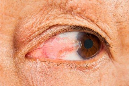 What to Know About the Price for Laser Eye Surgery UK? | Hasster