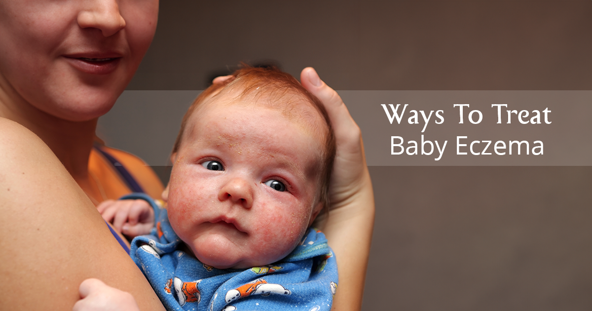 Cradle cap - Symptoms and causes                         – AreoVeda
