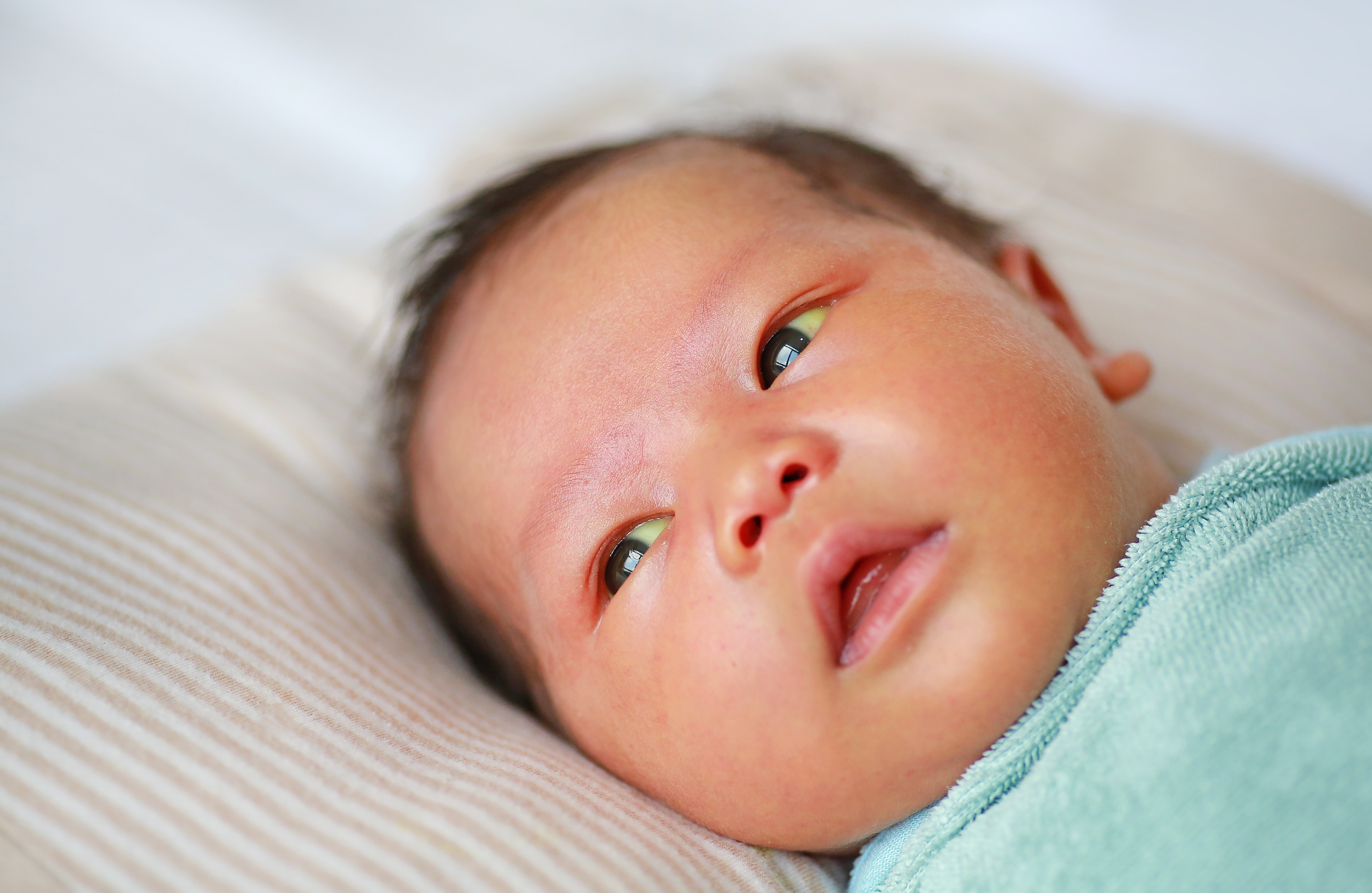 Jaundice In Newborns: When To Worry & How To Manage It
