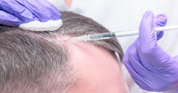 Finding the Right Hair Transplant Clinic: What to Look For – Forum Edualy – Questions and Answers