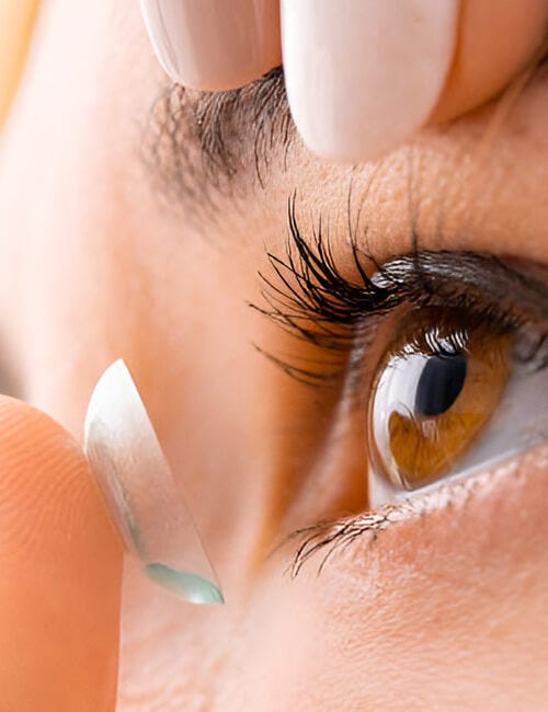 Orthokeratology Lens in Palo Alto, CA — Refine Optometry | by Refine Optometry | Aug, 2025 | Medium