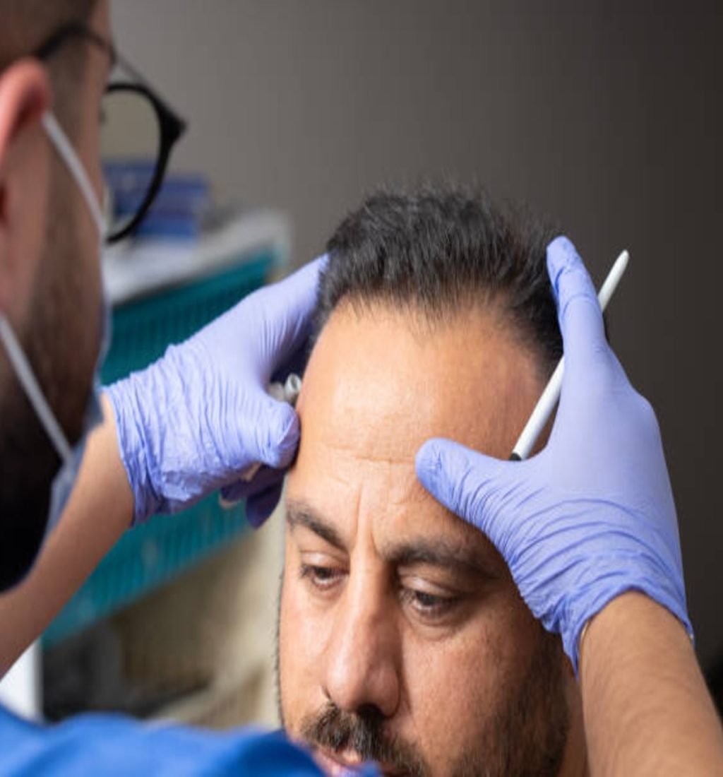 Best Hair Transplant In Kolkata | Hair Transplant Clinic