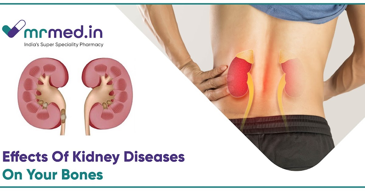 How Kidney Disease Affects Bones: The Pathophysiology of Renal Osteodystrophy