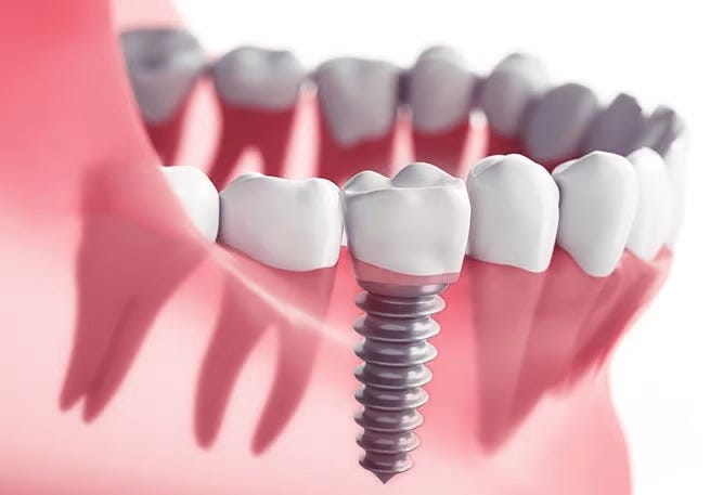 Transform Your Smile with Invisalign: Advanced Orthodontic Care in RR Nagar | by Symphonysmiles | Sep, 2025 | Medium