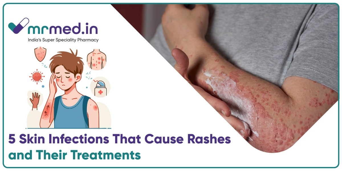 5 Skin Infections That Could Be Behind Your Rash