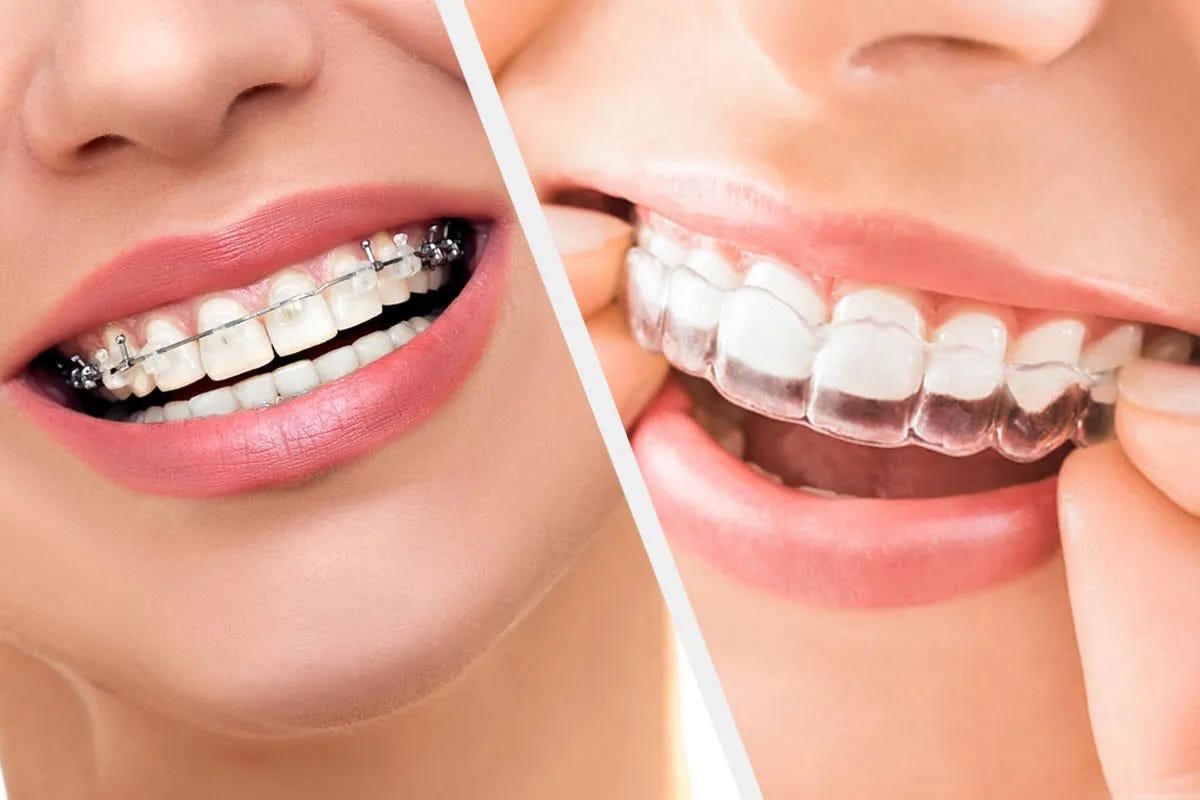 Orthodontist in RR Nagar is a dental specialist trained to correct irregularities in teeth… | by Symphonysmiles | Sep, 2025 | Medium