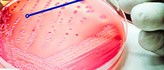 Bacteriological Testing Market Size, Share, Trends - 2030