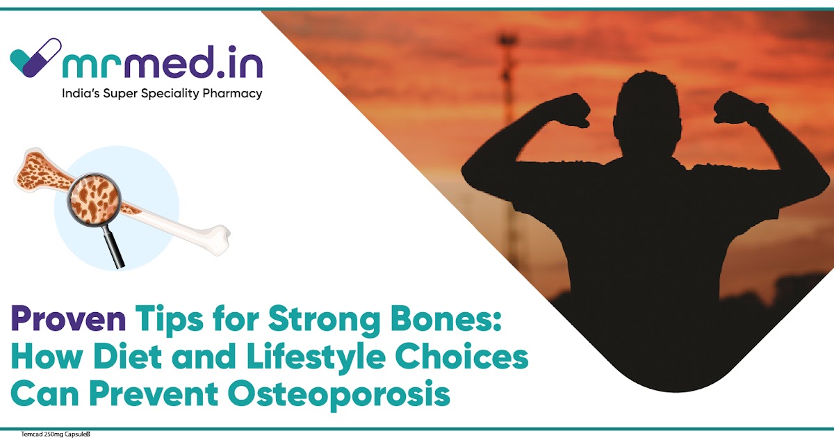 Strong Bones for Life: Proven Diet & Lifestyle Tips to Prevent Osteoporosis