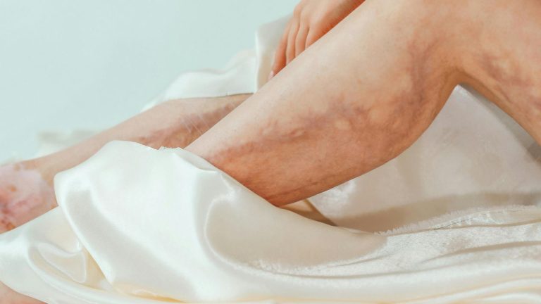 Rema Malik, MD | Board-Certified Vascular Surgeon in Houston