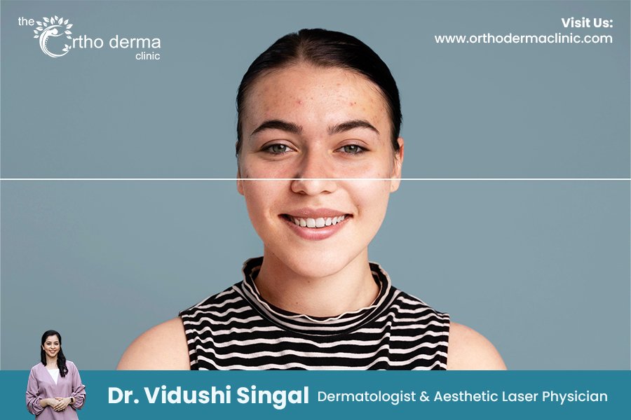 Pigmentation in Indian Skin: Causes & Expert Solutions