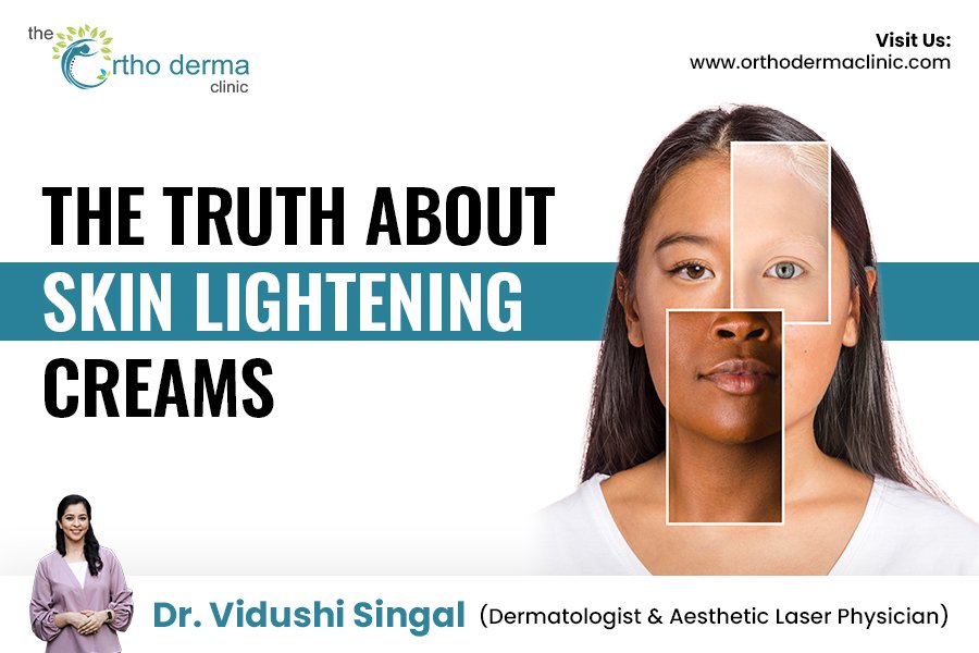 The Truth About Skin Lightening Creams: Dermatologist Insights by Dr. Vidushi Singal