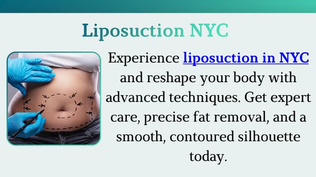 Liposuction                      NYC.pdf