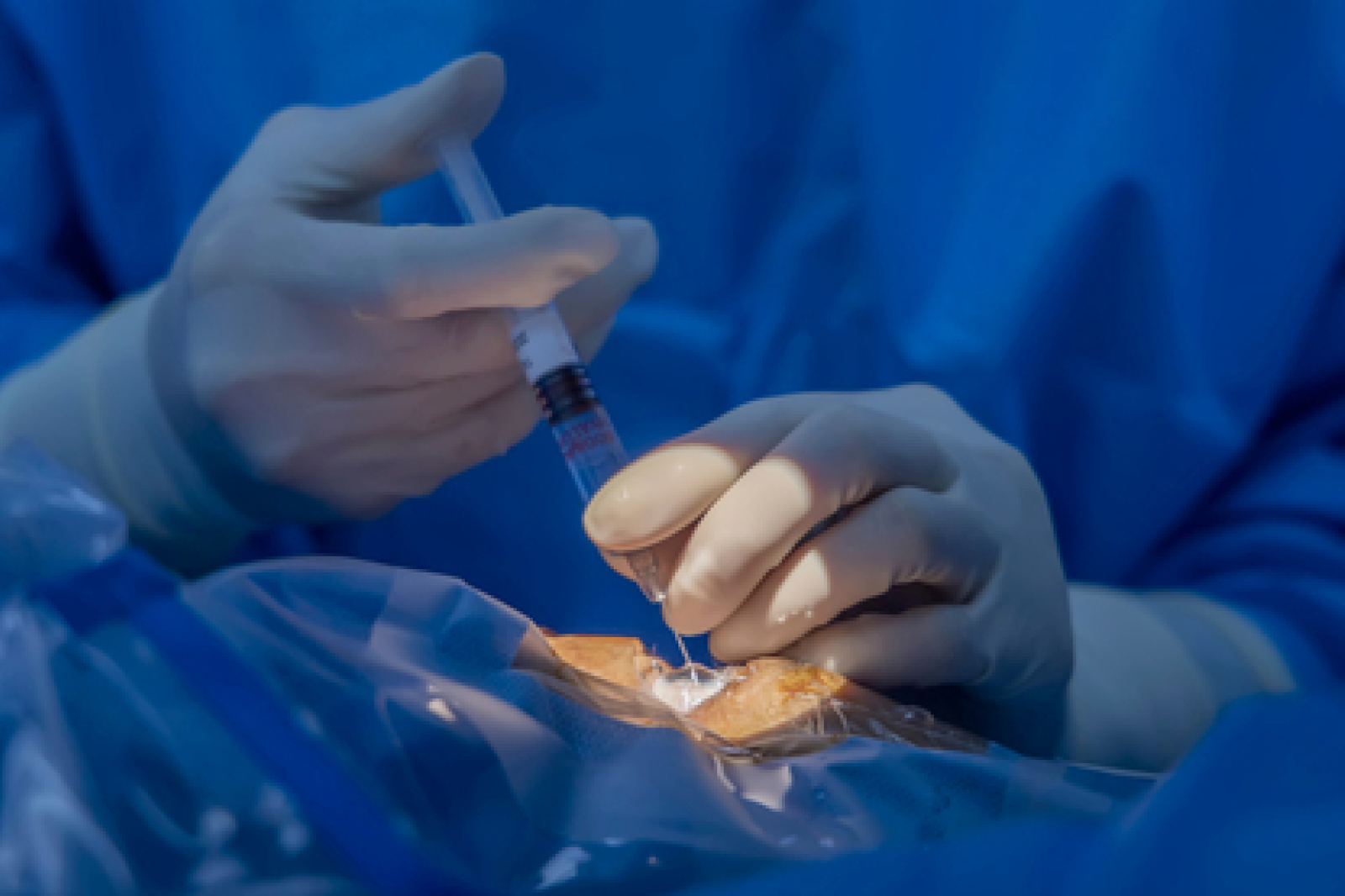 Posterior Uveitis Care in 2025: What Clinicians Are Doing Differently - Finsparrow