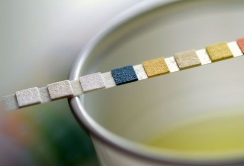 Mastering urine testing at home- Get accurate diagnosis and results