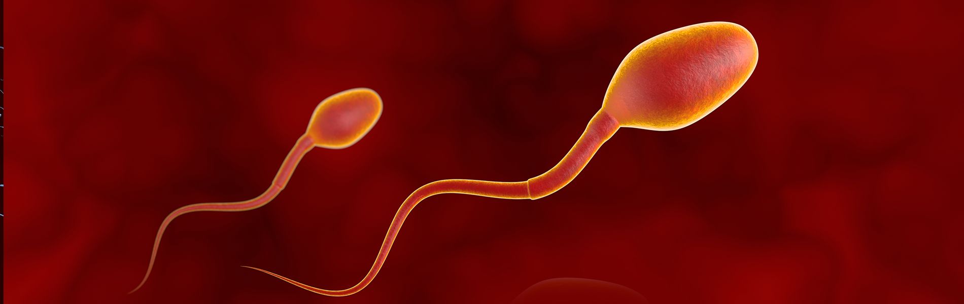 Total Motility Sperm Count - Basics and Overview