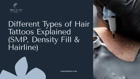Different Types of Hair Tattoos Explained (SMP, Density Fill & Hairline)