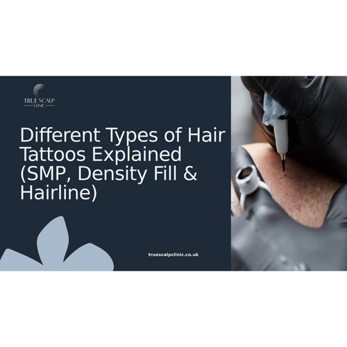 Different Types of Hair Tattoos Explained (SMP, Density Fill & Hairline)