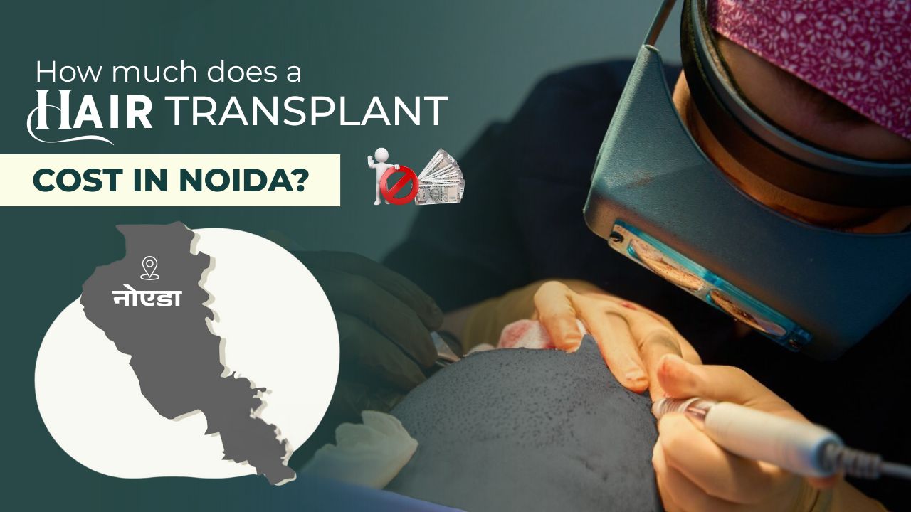 Hair Transplant Cost in Noida | Best Hair Transplant Clinic & Doctor