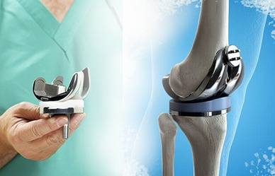 Best Knee Replacement Surgeon in Delhi NCR - Dr Nikhil Verma