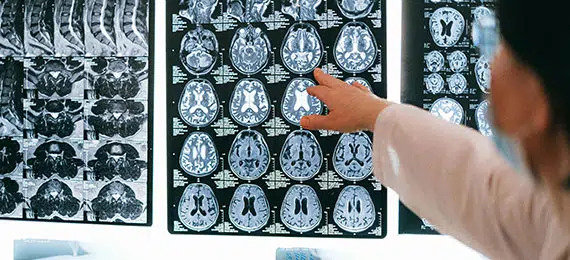 Why Choose PEMF Therapy Bethesda MD for Pain Relief? – DrPawluk