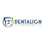 dentalign