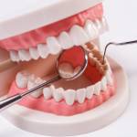 surgical Dental Extraction Procedure