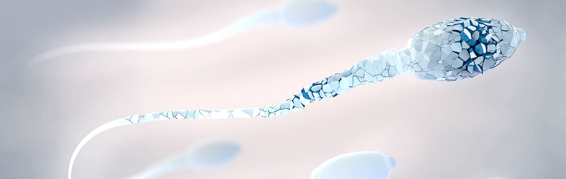 What is Sperm DNA Fragmentation? Know Causes, Risk Factors