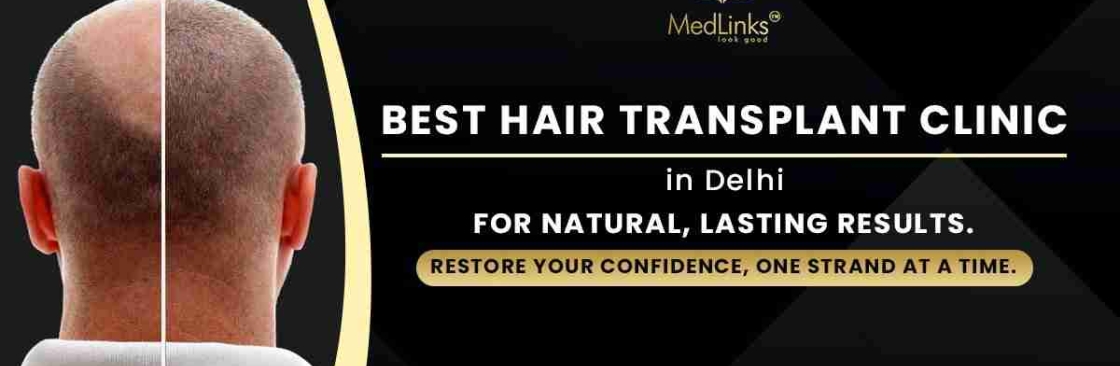 Medlinks hairtransplant