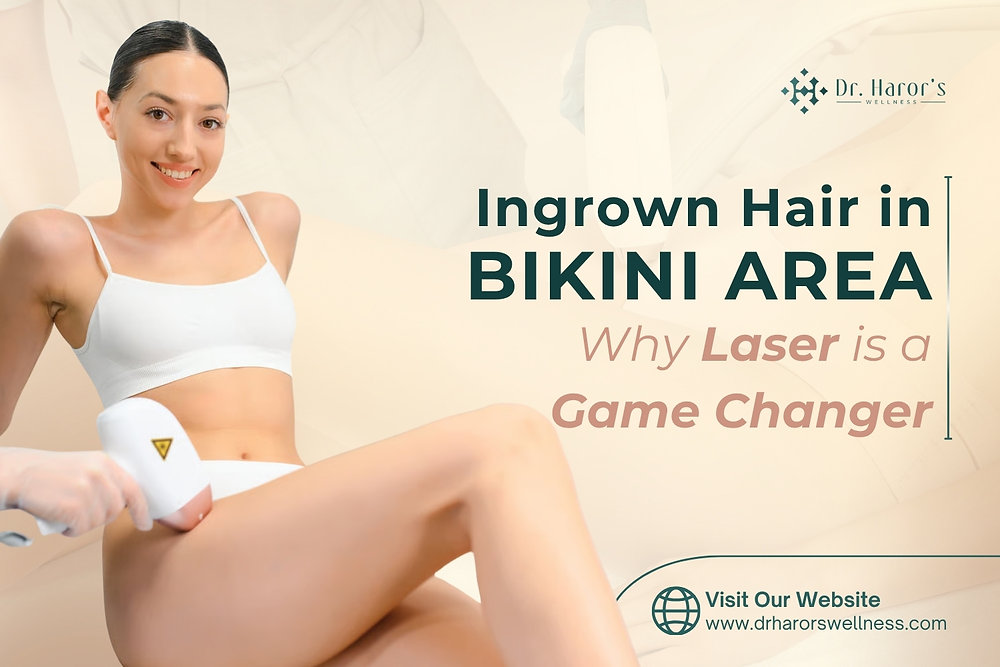 Ingrown Hair in Bikini Area: Why Laser is a Game Changer