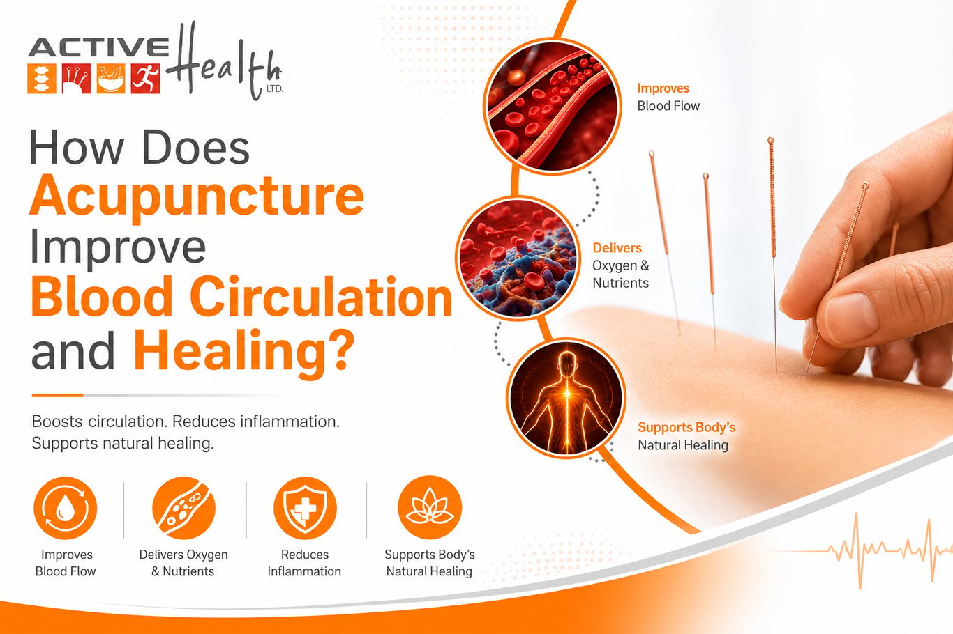 How Does Acupuncture Improve Blood Circulation and Healing? - Active Health - Matters