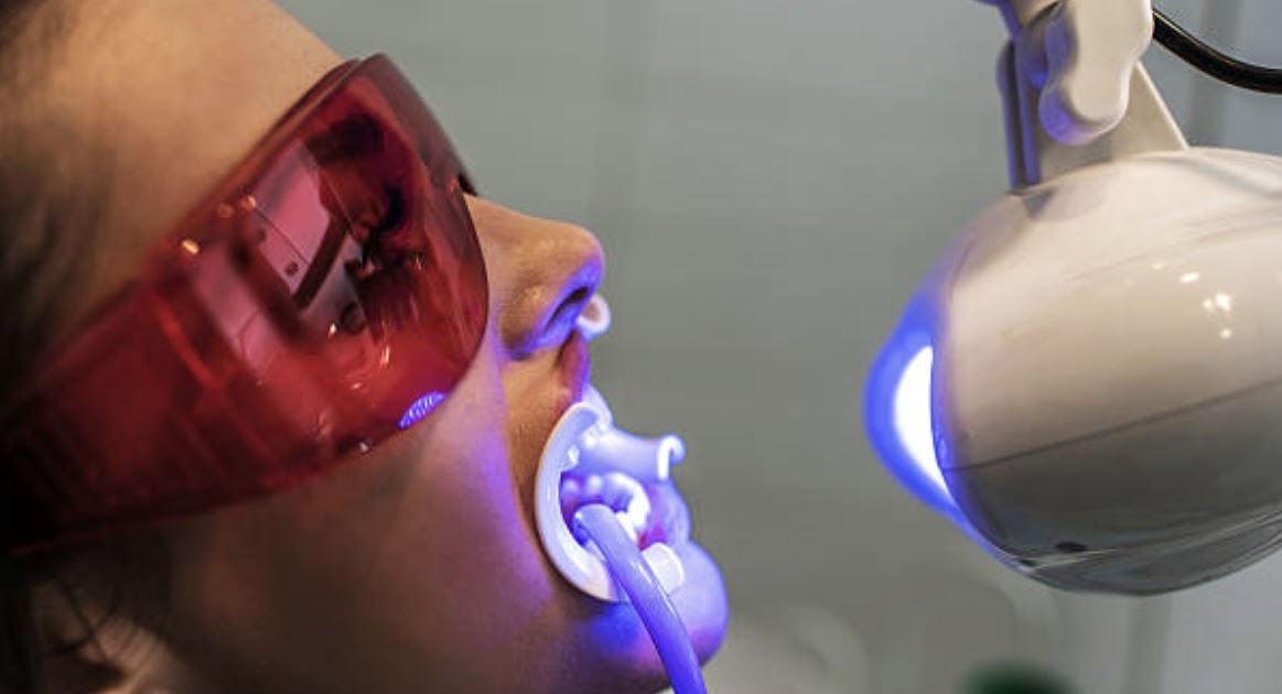 Stoddard Dental Square: Brighten Your Smile with Philips Zoom Whitening in Mount Roskill, Auckland