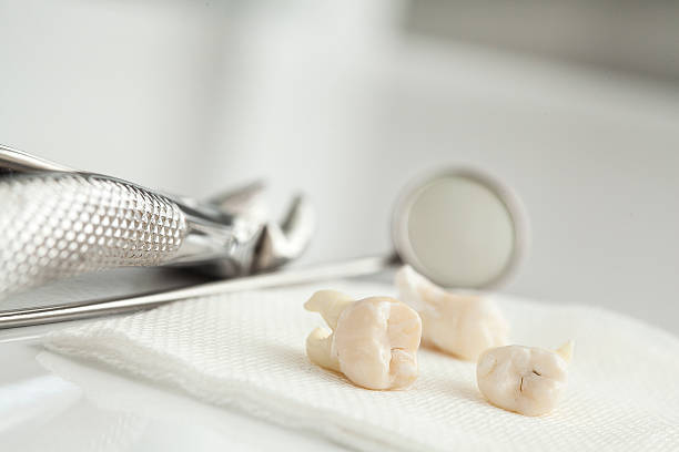 Expert Tips for a Smooth Wisdom Teeth Removal Procedure in Morris Plains