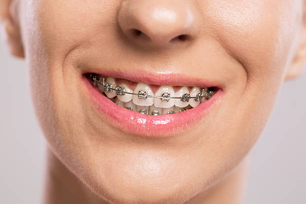 Beyond Straight Teeth: How Modern Orthodontic Care Creates Healthier, More Confident Smiles – Site Title