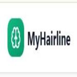 My Hairline