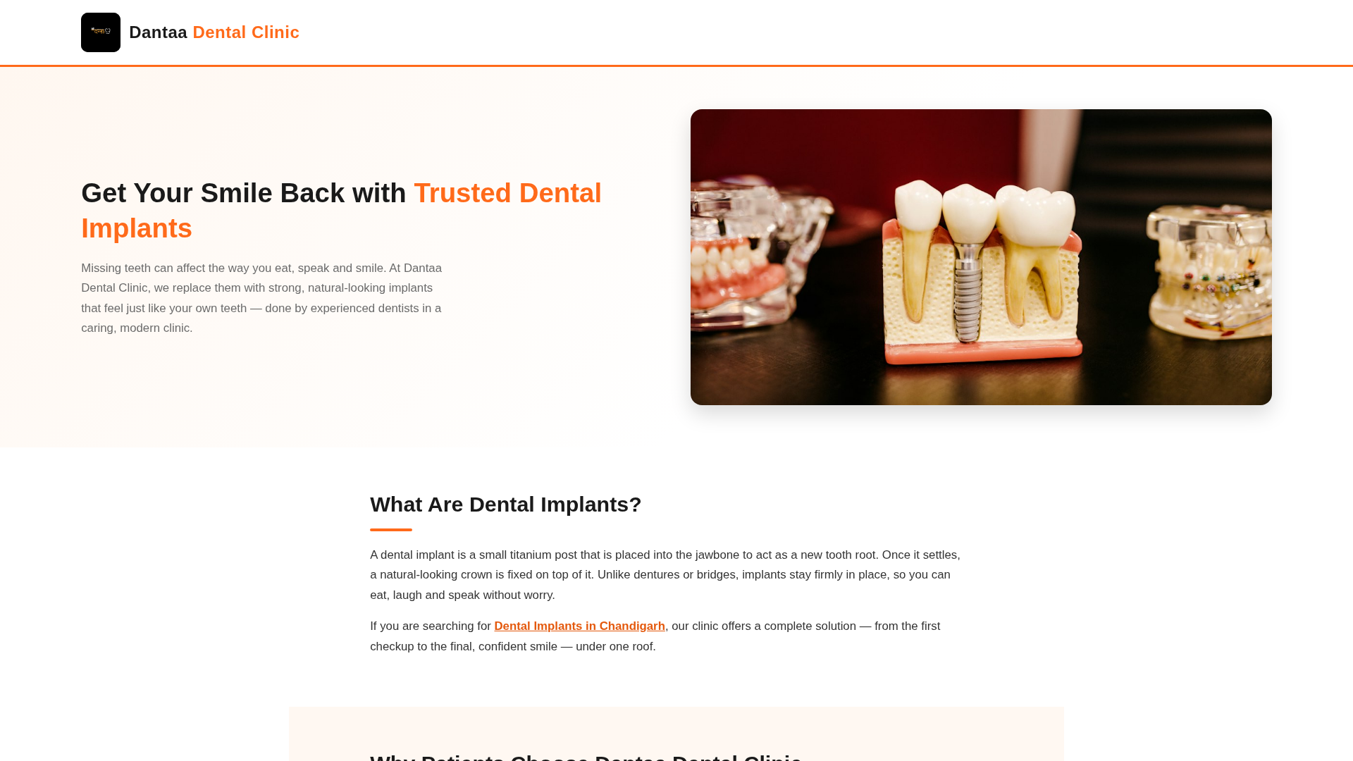 Dental Implants in Chandigarh | Dantaa Dental Clinic