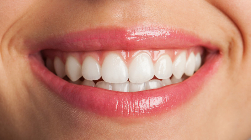 How Early Dental Care Can Support a Healthy, Confident Smile: ext_6702058 — LiveJournal