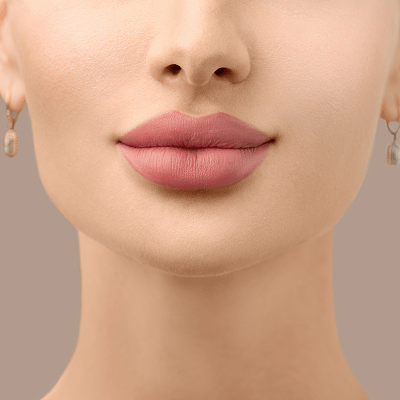 Russian Lip Fillers in Dubai & Abu Dhabi | Russian Lip Price & Cost
